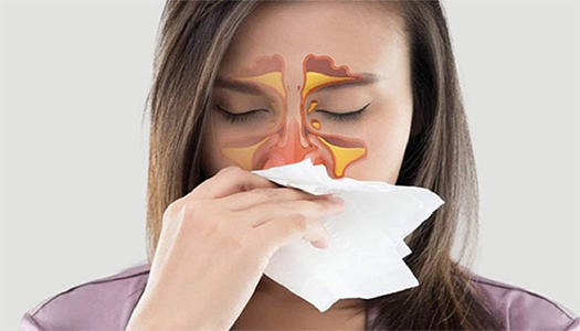 Chọn thuốc trị viêm mũi